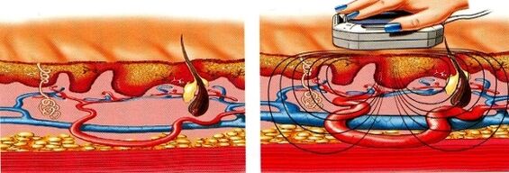 όταν μουδιάζουν τα πόδια